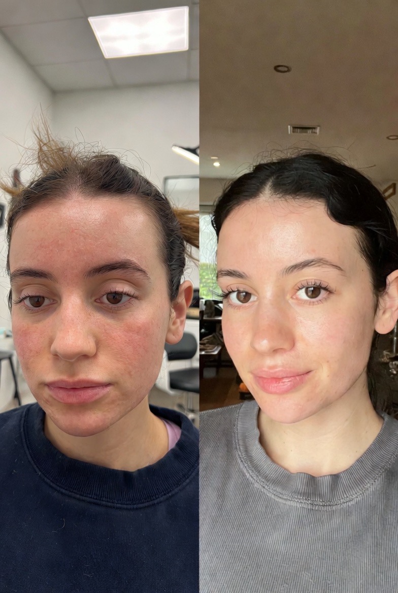 a person posing for the camera