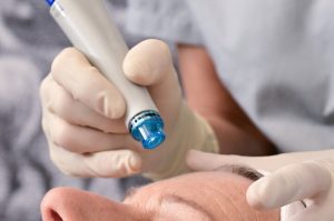 hydrafacial, hydraglow, palo alto, From Europe With Love
